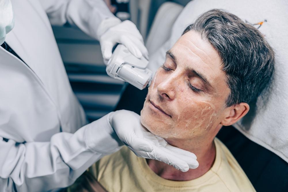 Traitement HIFU visage Traitement HIFU visage