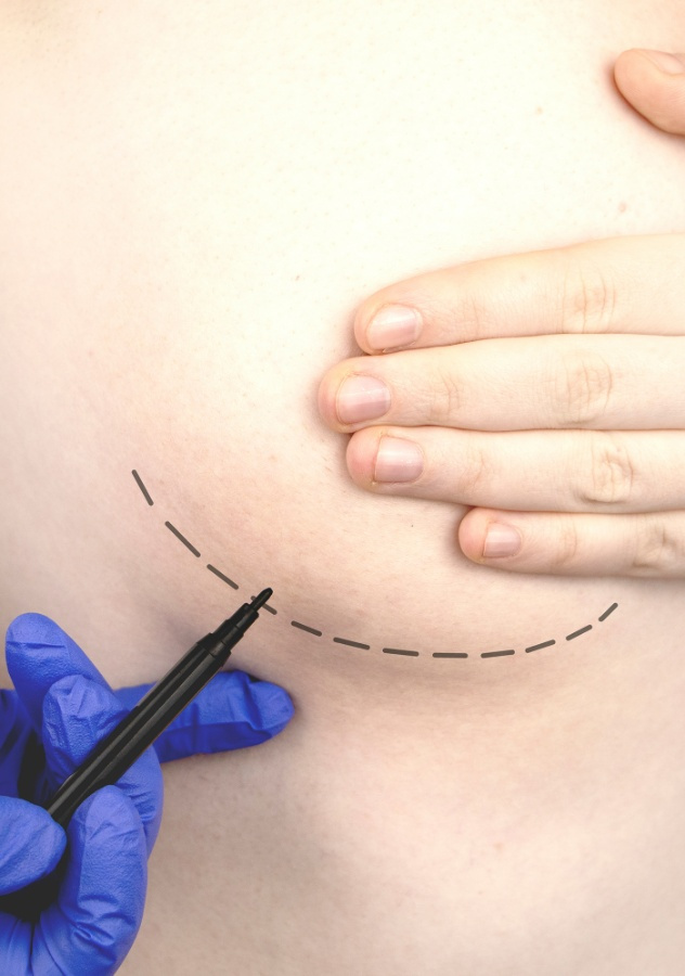 chirurgie esthétique