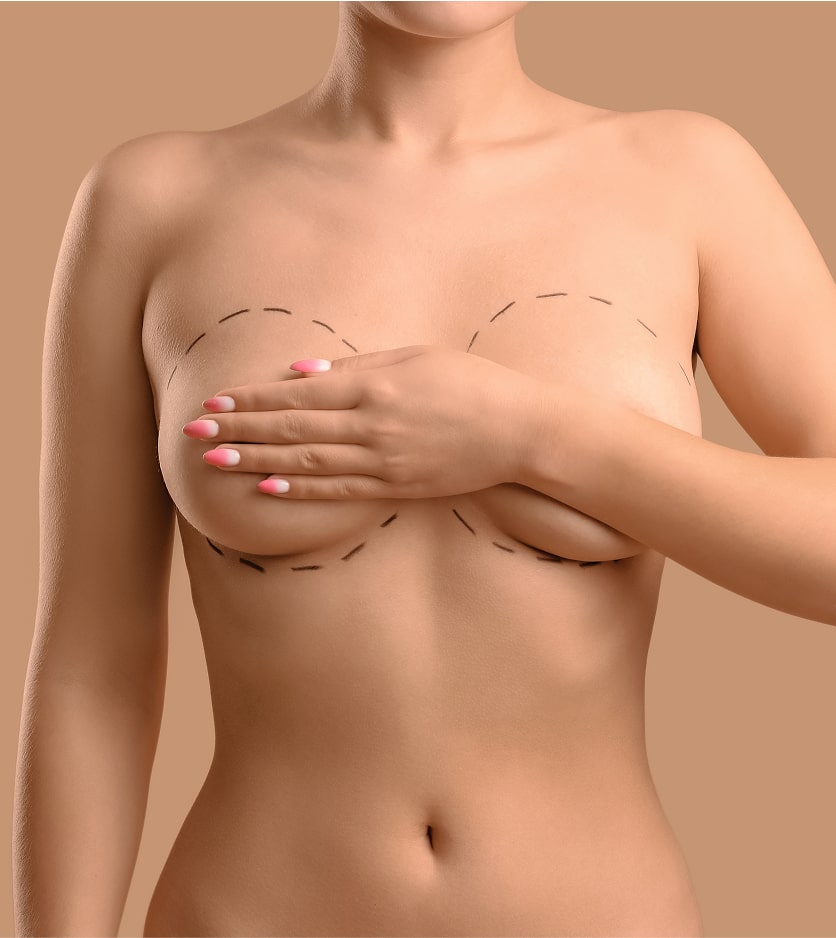 Chirurgie mammaire